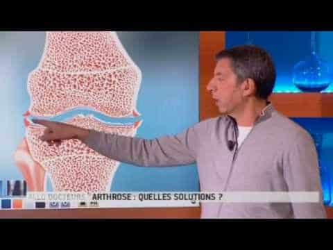 Qui a rapport aux articulations