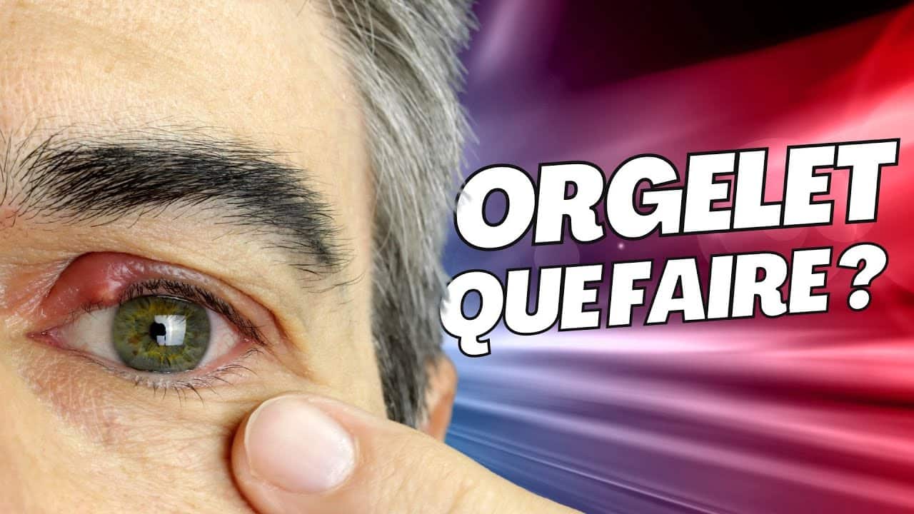 Comment Guérir Un Orgelet