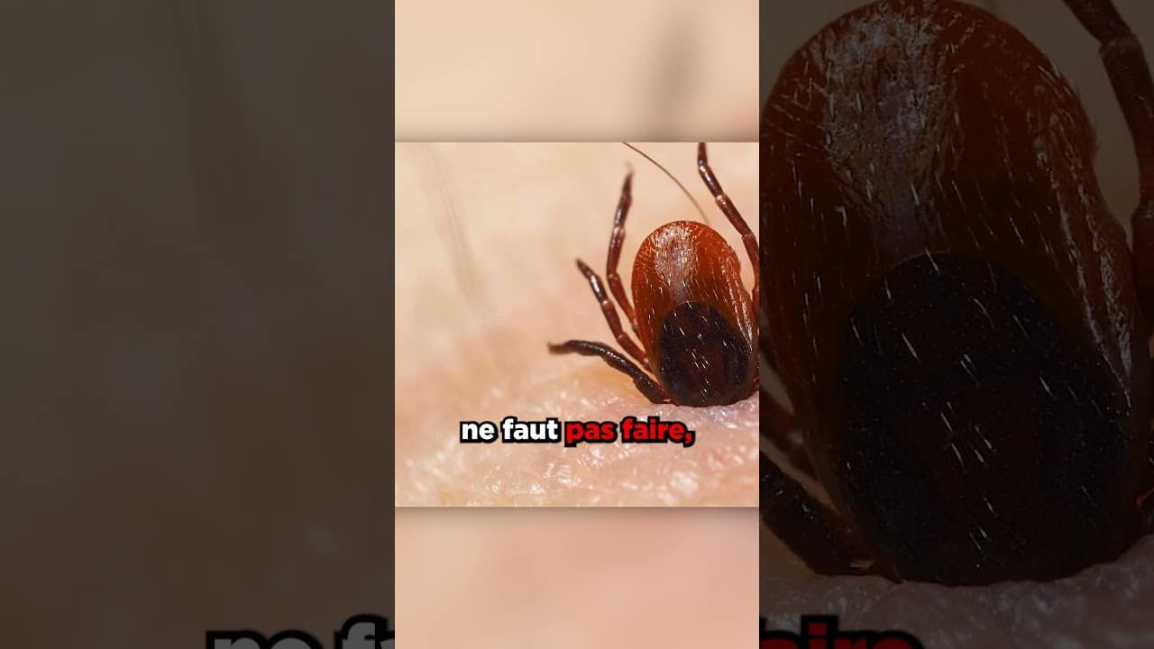 Etait De La Calotte Mots Fléchés