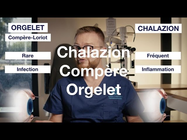 Chalazion