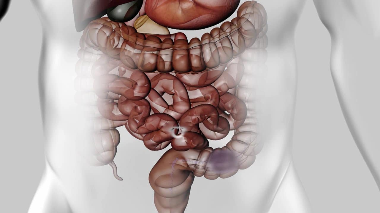 Infection digestive
