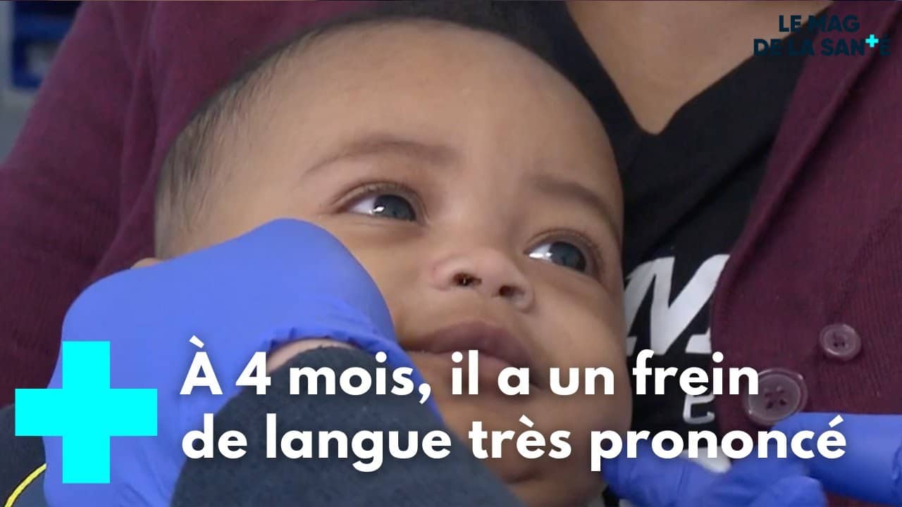 frein de langue bébé