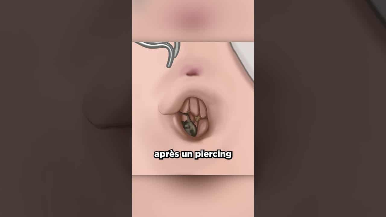 infection de la peau mots fléchés