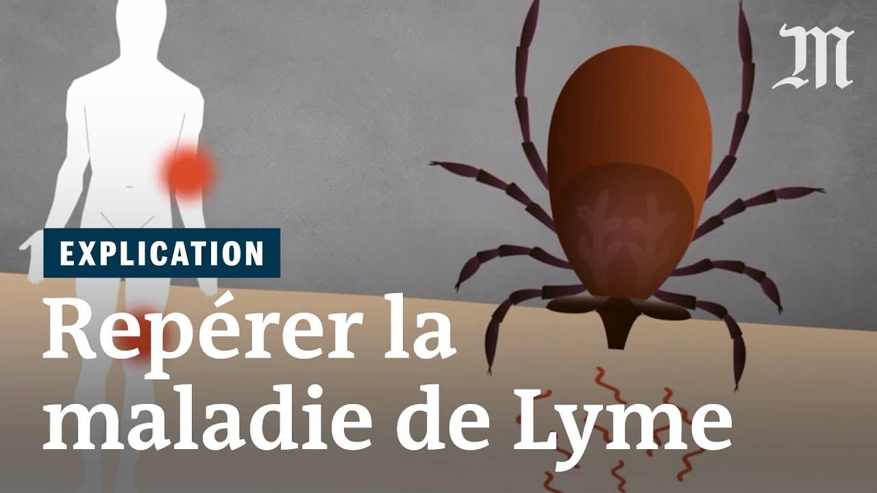 Symptome Maladie De Lyme