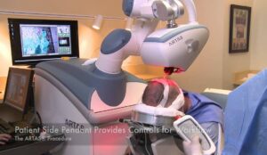 robot soins alopecie
