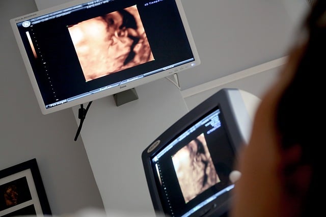 echographie plaisir