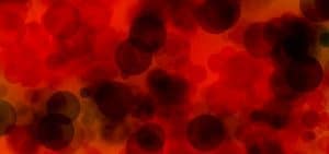 plasma sang